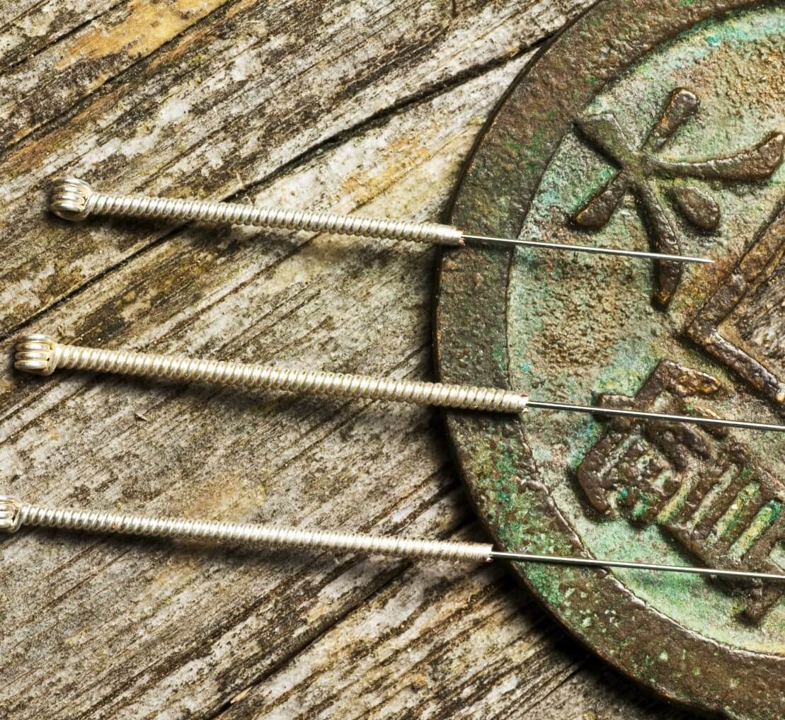 Acupuncture For Premature Ejaculation - It Works ...