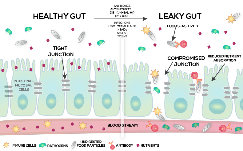 leaky gut and testosterone levels in men